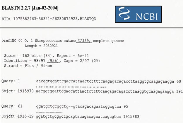 igura 3 Comparación de una de las secuencias obtenidas (Sm5) con la secuencia del S. mutans UA159, publicadas en la base de datos BLAST. www.ncbi.nlm.nih.gov/blast/Blast.cgi