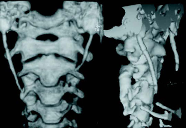 Figura 3