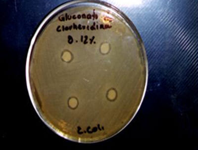 Fotografías No. 3-a y 3-b Halos de inhibición bacteriana causados por el Gluconato de clorhexidina al 0.12 %, frente a S. aureus y E. coli.