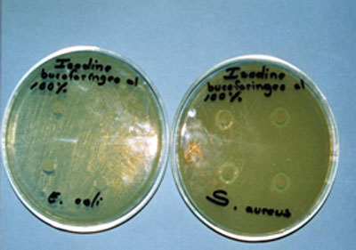 Fotografía No. 5 Halos de inhibición bacteriana causados por la Iodopovidona (Isodine bucofaringeo al 0.8 %), frente a S. aureus y E. coli.