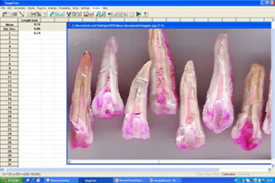 FIGURA 3 Análisis de los especímenes en software Image Tool for Windows v.3.00