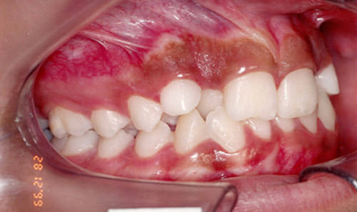 Figura Nº 2