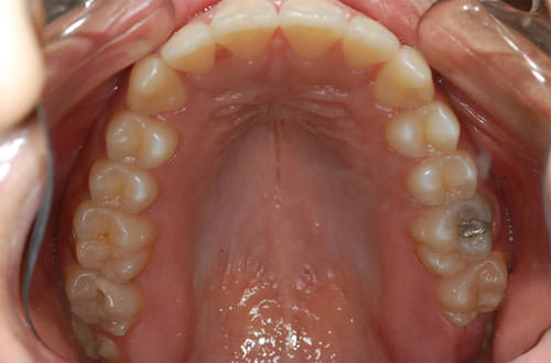 Figura Nº 5