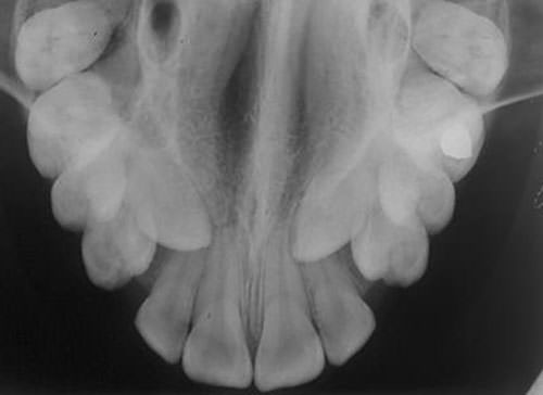 Figura Nº 7