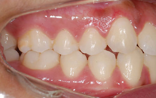 Figura Nº 11