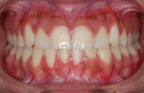 Figura Nº 13