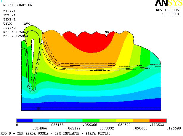 Figura 3 Mapa de desplazamiento del modelo B