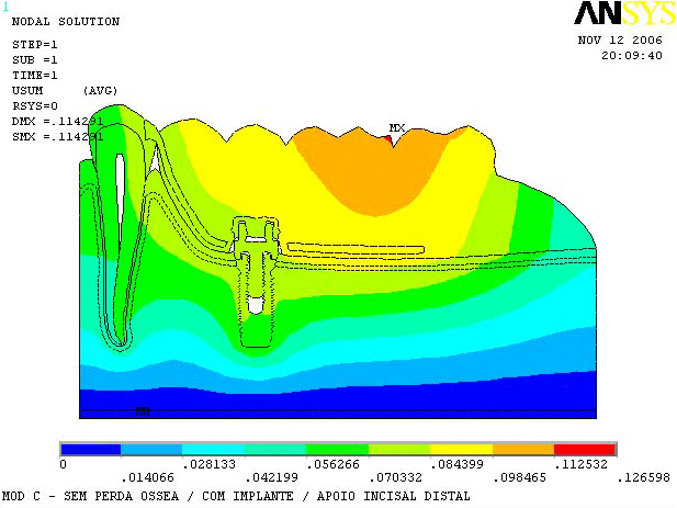 Figura 4 Mapa de desplazamiento del modelo C