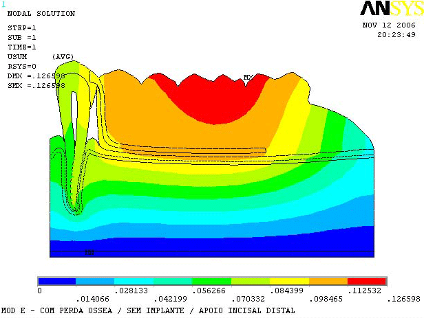 Figura 6 Mapa de desplazamiento del modelo E