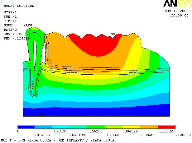 Figura 7 Mapa de desplazamiento del modelo F