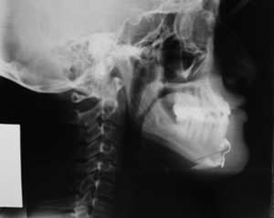 Fig. 4 Radiografía Postoperatoria.
