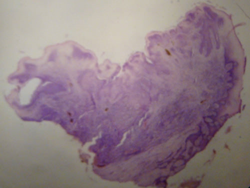 Fig. 5 Corte histológico Hematoxilina-eosina (10x)