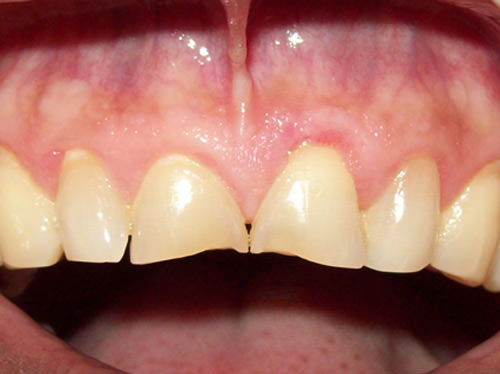 Fig. 6 Post operatorio satisfactorio a los 7 meses