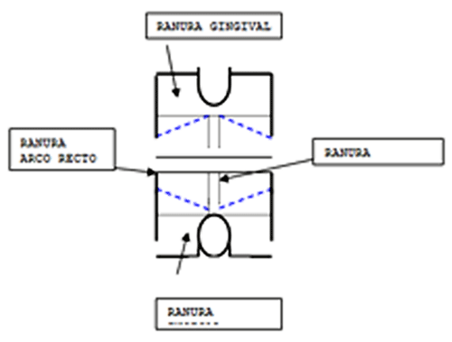 Fig. 5.- Bracket de Combinación en cerámica. Vista frontal.