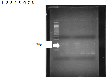 Fig.1 Detección molecular de VEB en pacientes con LPB.