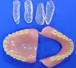 Figura 8 Dispositivos y prótesis totales preparadas al realizarse el desgaste de la superficie oclusal, limpias para recibir el agente de unión.