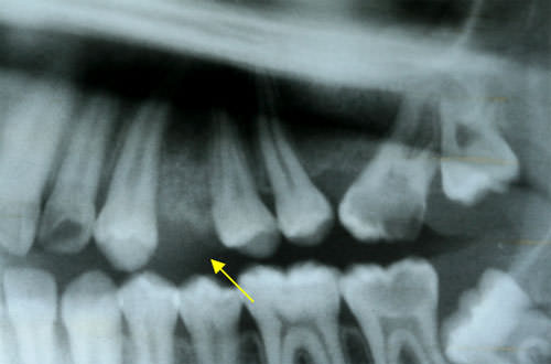 Fig 3