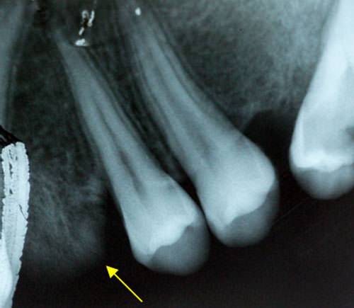 Fig 4