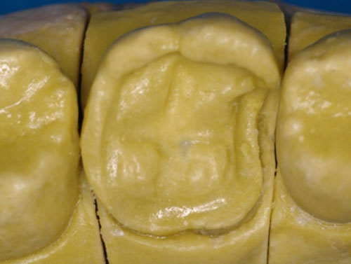 Fig. 5 Modelo de trabajo troquelado aislado con vaselina.