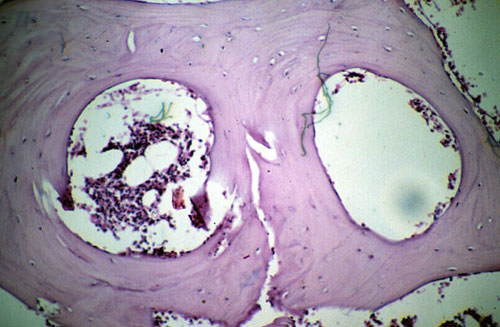 Fig. 5 Examen histopatológico.