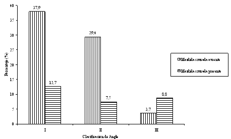 Figura 1 Mordida cruzada según la clasificación de Angle en pacientes pre-ortodóncicos de 8 a 15 años. São Luís, MA- 2006.