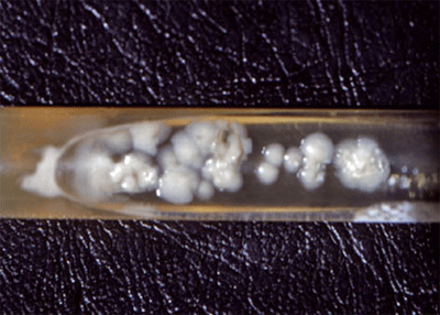 Figura 1: Observación a simple vista de crecimiento de colonias en medio de cultivo Agar Sabouraud.