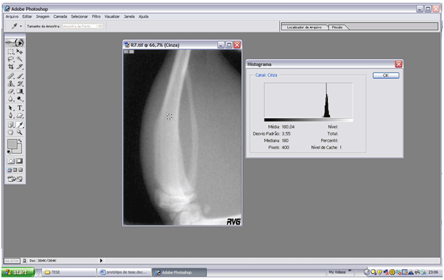 Figura 1 Imagen de la tibia en el programa Adobe Photoshop, demostrando el área de diáfisis seleccionada para la medición y el gráfico en histograma suministrando el promedio de la densidad óptica radiográfica de la región analizada.