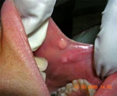 Figura Nº 2