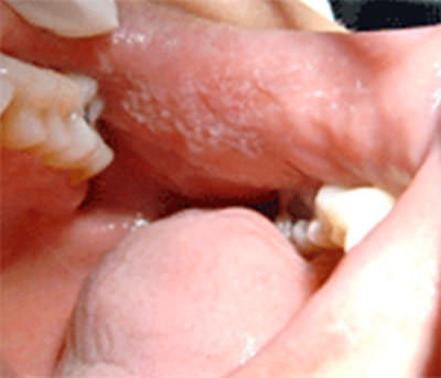 Figura Nº 4