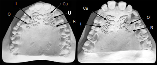 Fig. 3 R: Rectas, O: Onduladas, Cu: Curvas, Ci: Circulares, I: Inespecíficas. U: Unificaciones/Ramificaciones.