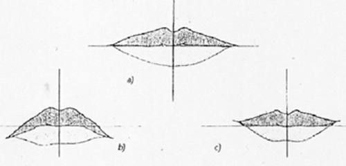 Fig. 5 Dibujo esquemático en donde se representa la dirección de la comisura. A: Horizontal, B: Decaidas o abatidas, C: Elevadas. Tomado de http://www.mailxmail.com/curso/vida/identidadpordientes/capitulo23.htm en Julio 2008.