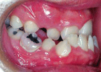 Fig. 11
