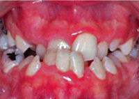 Fig. 12