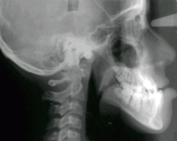 Fig. 13