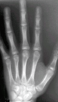 Fig. 15