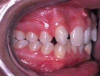 Fig. 18