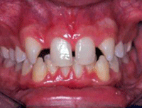 Fig. 19