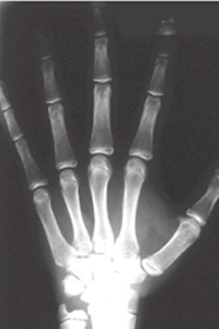 Fig. 22