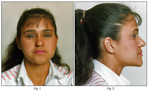 Figuras 1 y 2