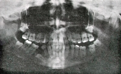 Figura 9