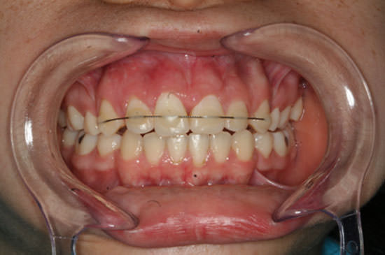 Fig 9