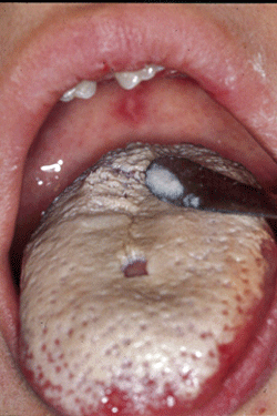 Figura 3