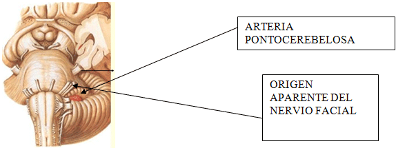 Figura 3 Origen Aparente del nervio facial.